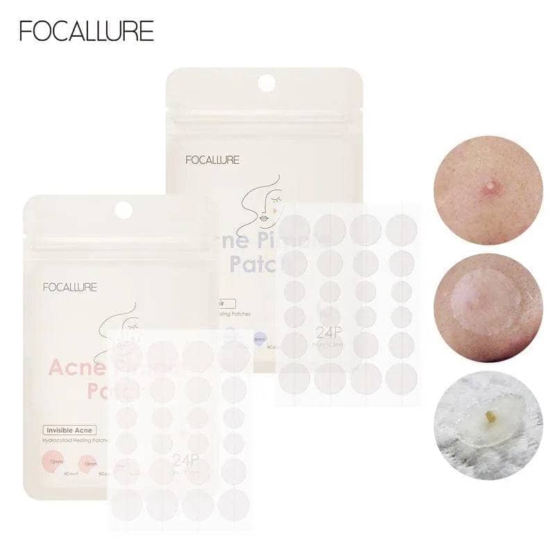 Spot Patch/Blemish Treatment/Acne Repair